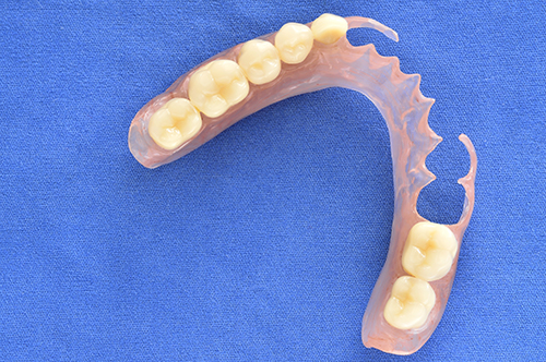 Removable Dentures in Plainview